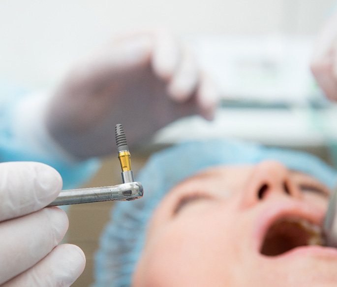 A patient undergoing dental implant surgery