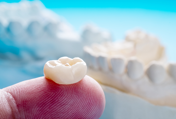 Dental crown resting on a finger