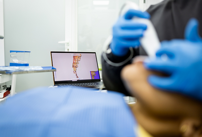 Dentist capturing digital impressions of a patients teeth
