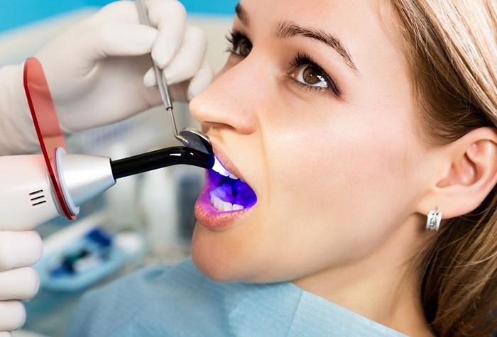 Hands applying UV light to woman’s filling