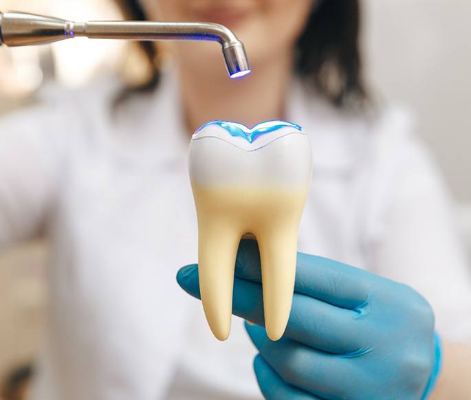 Dentist hardening bonding on large model tooth with UV light
