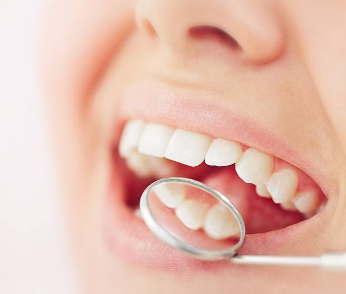 Closeup of woman smiling with dental mirror reflecting 3 teeth