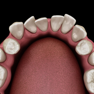 Example of crowding in Salmon Creek