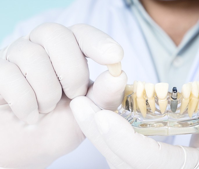 Man in white gloves holding sample dental crown and implant