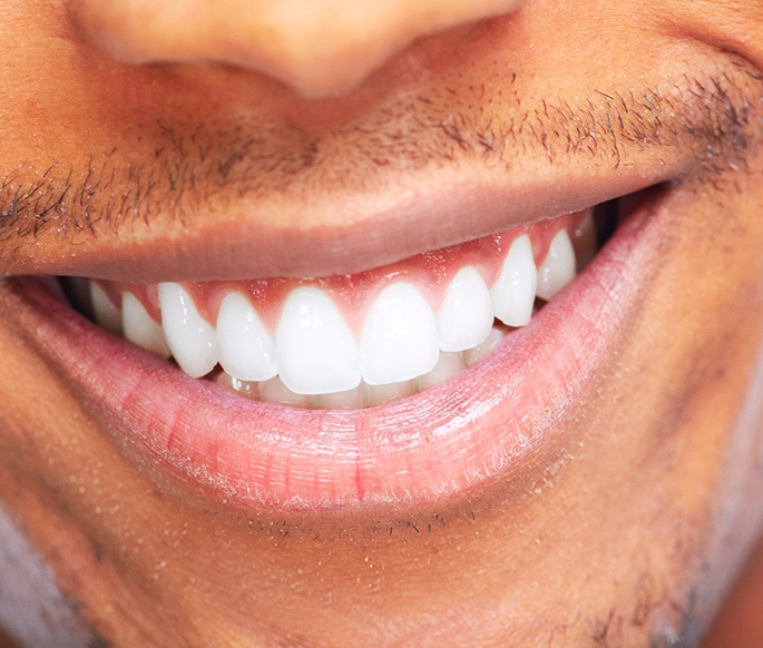 Man showing off his smile
