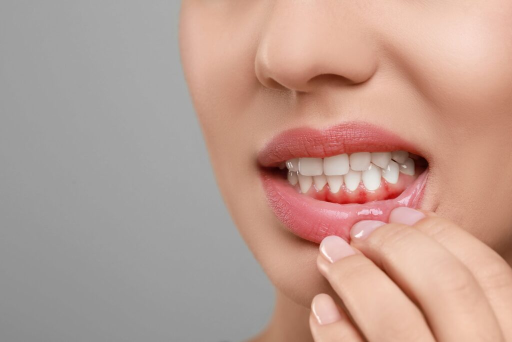 Woman pulling down lower lip to reveal red gums